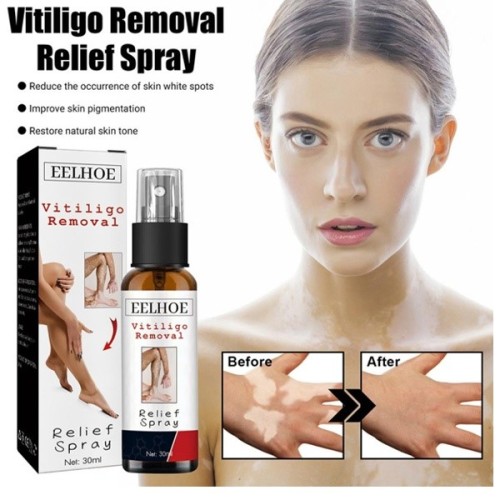 Eelhoe Vitiligo Repair Spray